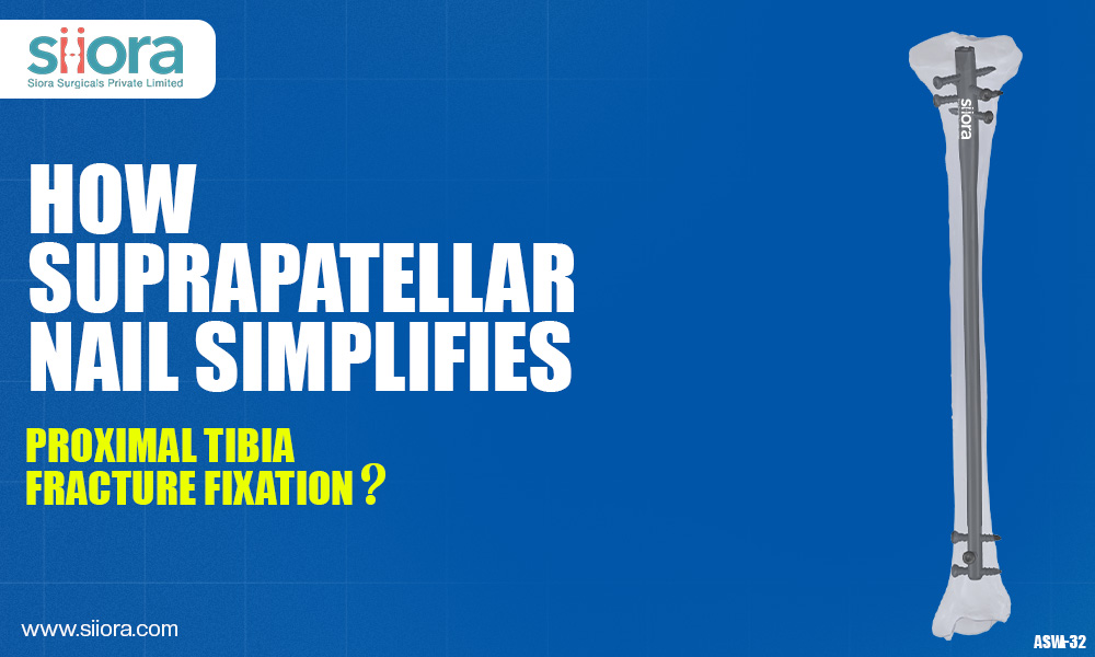 How Suprapatellar Nail Simplifies Proximal Tibia Fracture&nbsp;Fixation?