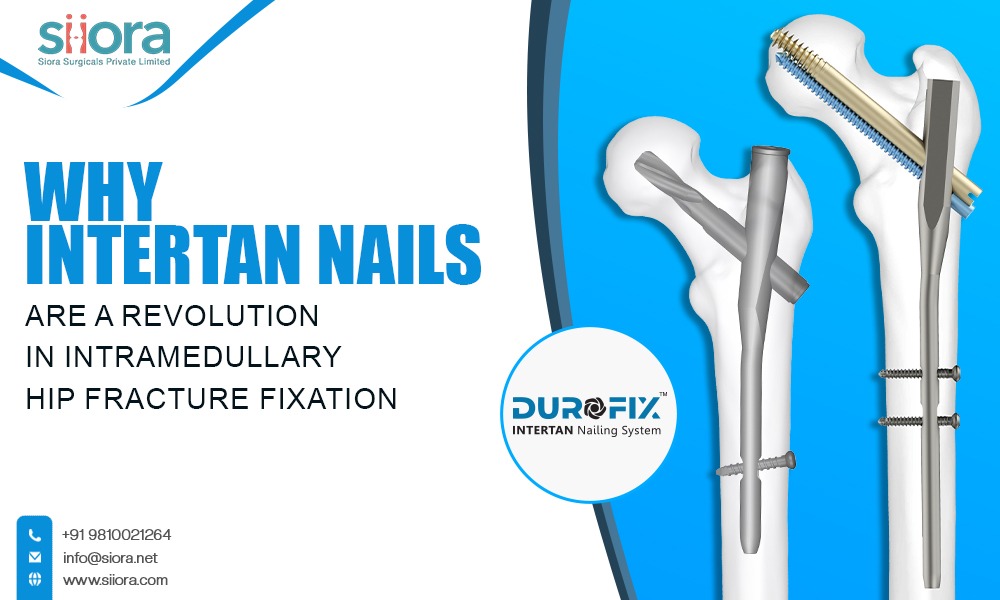 Why Intertan Nails Are a Revolution in Intramedullary Hip Fracture&nbsp;Fixation?